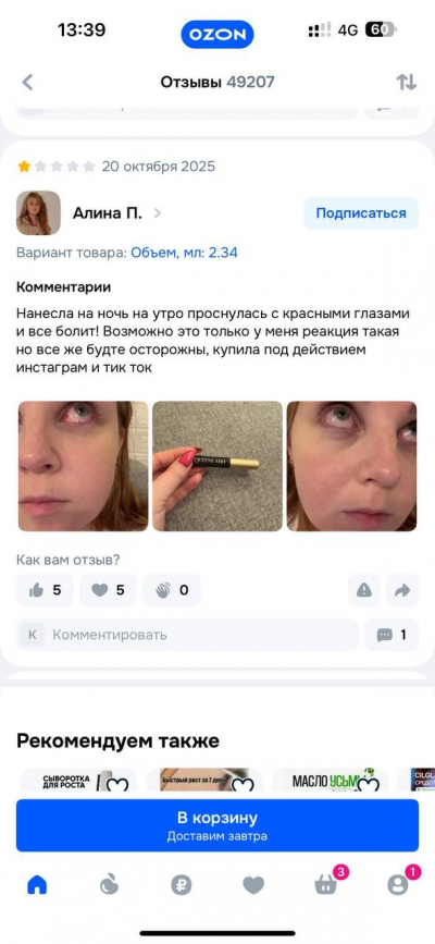 Сыворотка для роста ресниц «Квинлаш» опасна для зрения: скрытый биматопрост под видом «пептидов»