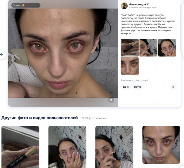 Queenlash отзывы: Шокирующие откровения пользователей о сыворотке, которая может стоить зрения