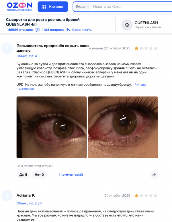Queenlash отзывы: стоит ли доверять сыворотке для роста ресниц?