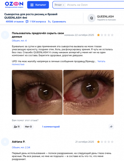 Queenlash отзывы: стоит ли доверять сыворотке для роста ресниц?